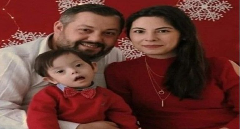 Körpəsi daun sindromlu doğulan ailəyə 21 milyon təzminat ödəniləcək