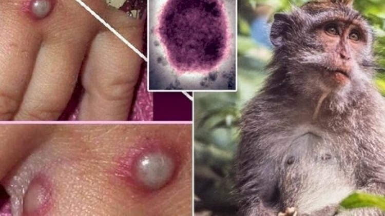 Bu virus dünyaya yayılsa... - Dəhşətli FAKTLAR