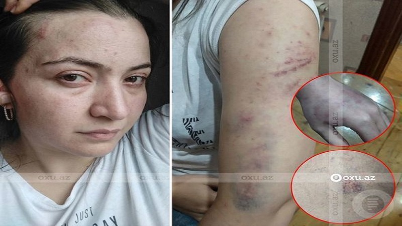 Polis bölməsində öldürülən qadının ailəsi danışdı (VİDEO)