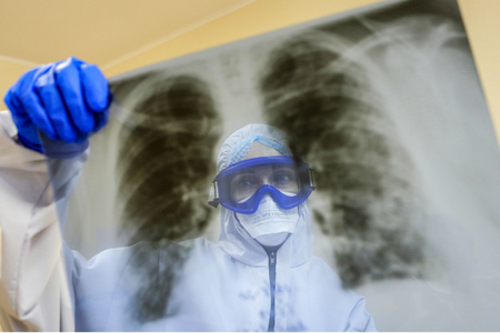 Koronavirus pandemiyası vərəmlə mübarizəni çətinləşdirir - AÇIQLAMA