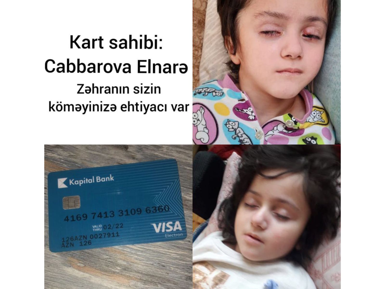 Serebral İflicdən əziyyət çəkən Zəhraya kömək edək