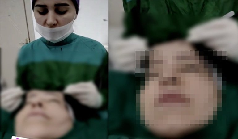 Həkim üzgərmə əməliyyatında canlı yayım açdı - Araşdırma BAŞLADI