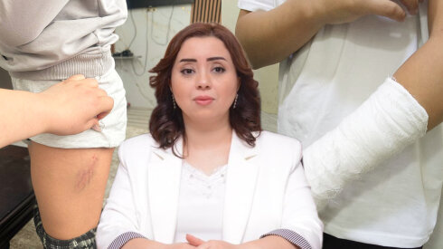 Bu məktəbdə xəsarətlə nəticələnən münaqişə valideyndən GİZLƏDİLDİ - FOTO