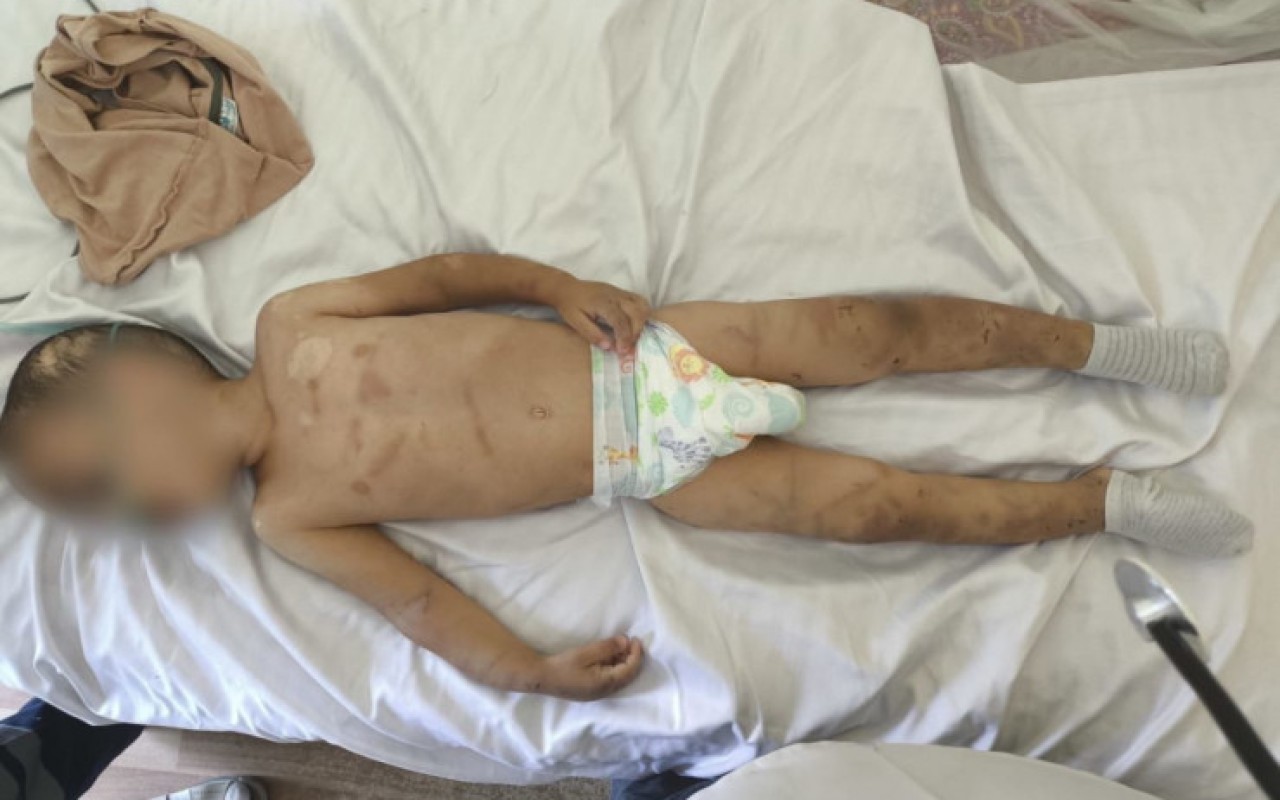 Valideynləri tərəfindən döyülən azyaşlıların son durumu