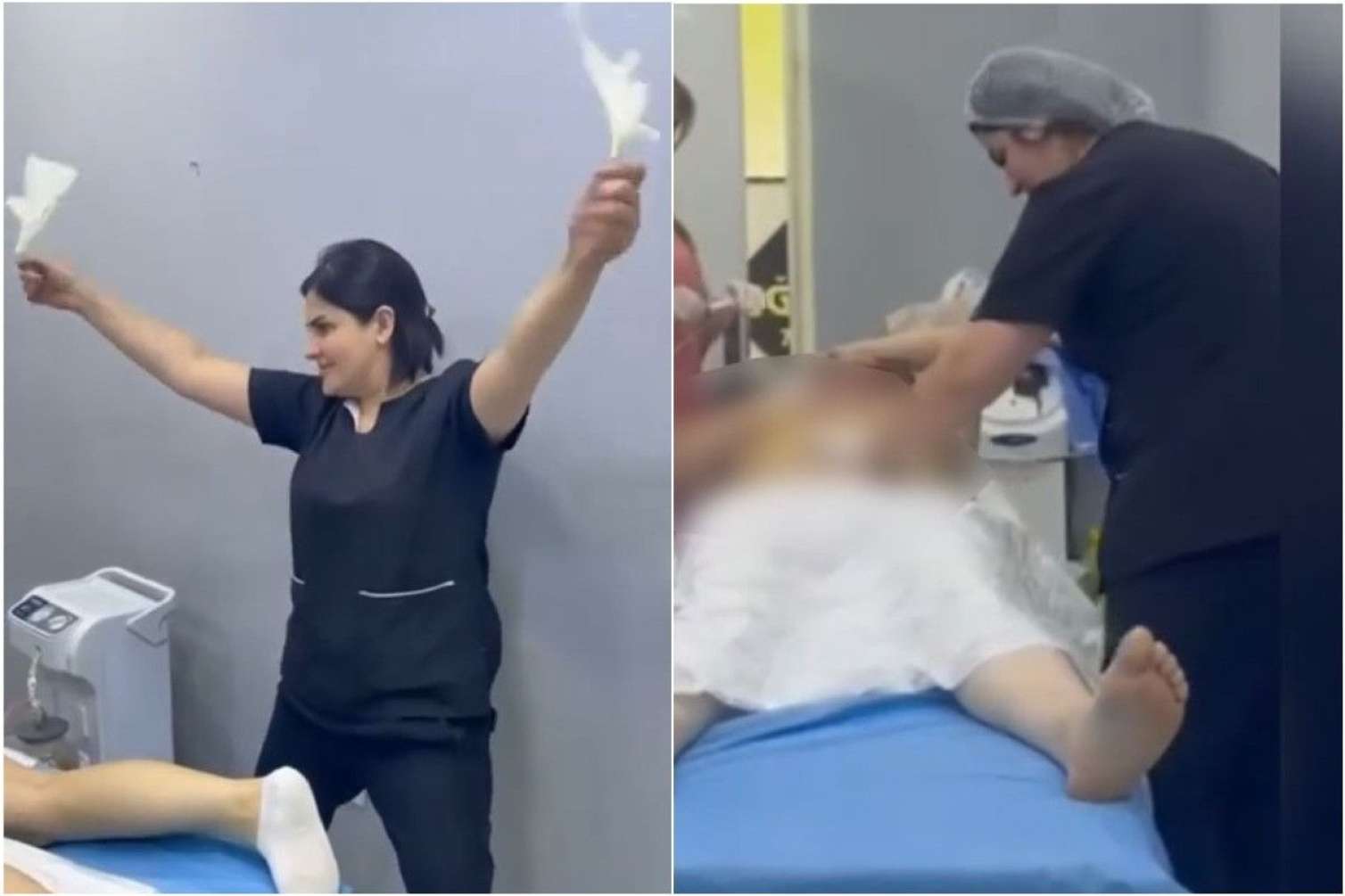 "Doktor Gülü" əməliyyat masasındakı qadının LÜT GÖRÜNTÜSÜNÜ YAYDI - VİDEO