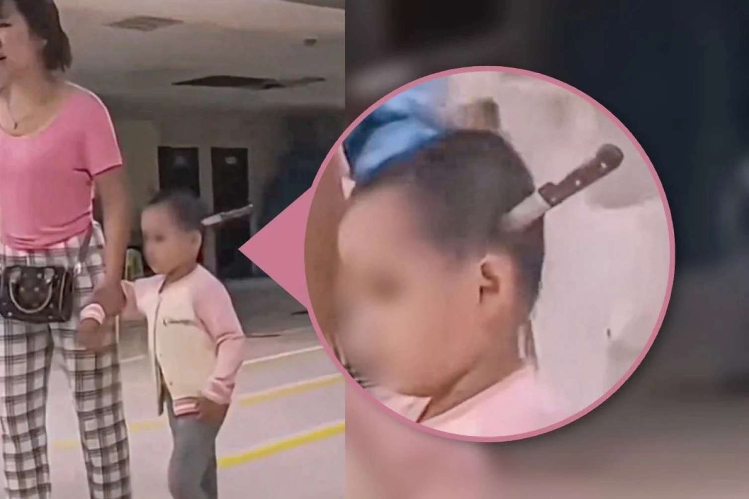 Azyaşlının başından 15 santimetrlik bıçaq çıxarıldı - FOTO