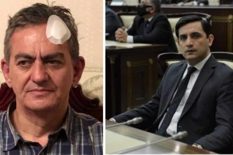 Əli Kərimli ilə bağlı ŞOK FAKTLAR açıqlandı