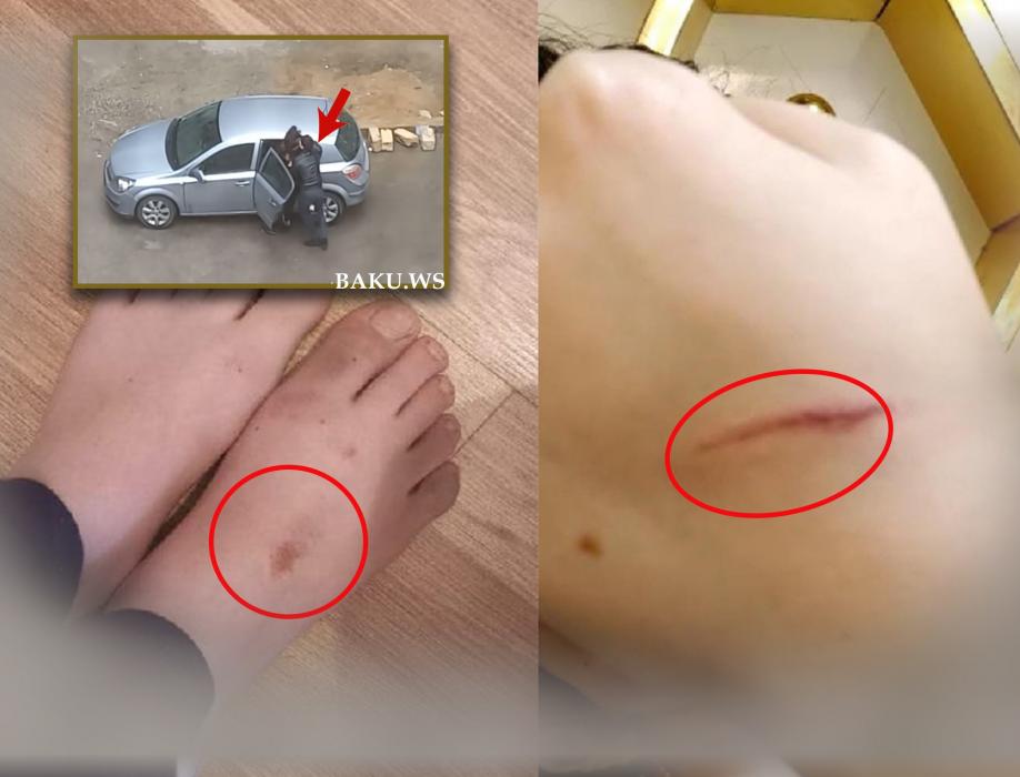 Küçədə qaçırılan qadınla bağlı ŞOK DETALLAR - Gələn gündən şiddət görür - FOTO