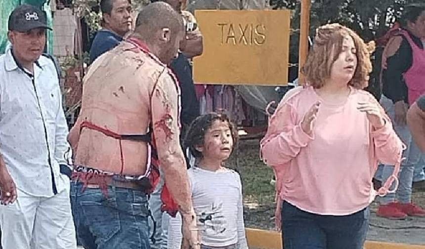 Daha bir ölkədə dəhşətli partlayış - 35 yaralı - FOTO
