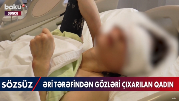 Əri tərəfindən gözləri çıxarılan qadının GÖRÜNTÜLƏRİ - VİDEO