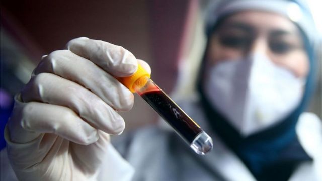 Azərbaycanda koronavirusa daha 49 yoluxma faktı qeydə alınıb