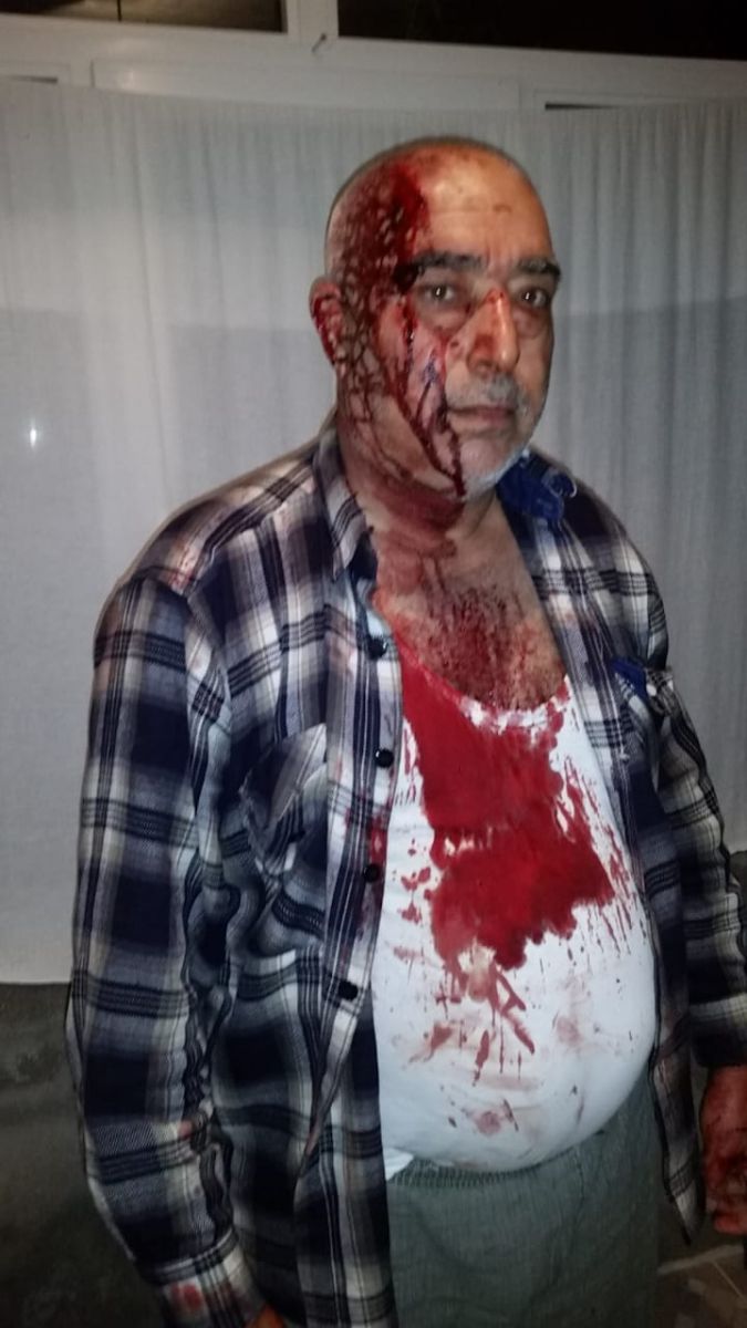 Masallı polisi cinayəti etiraf edən oğruları niyə həbs etmir? 