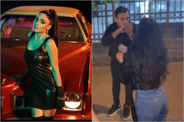 Azərbaycanlı müğənni İstanbulda taksi sürücüsü tərəfindən döyüldü - FOTO+VİDEO