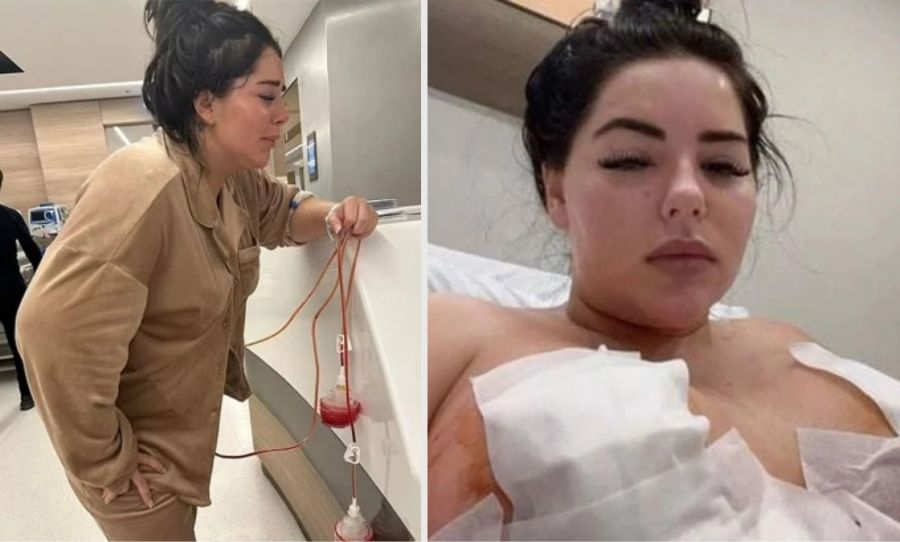 Plastik əməliyyat etdirən 22 yaşlı modelin sinəsi çürüyür - FOTO