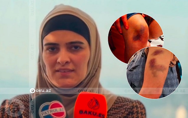 “Silahı başıma dirədi” - Polkovnik-leytenantın arvadı - Video