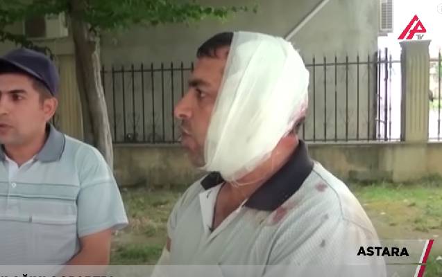 “Bir də gördüm, qulağım yoxdur…” - Video